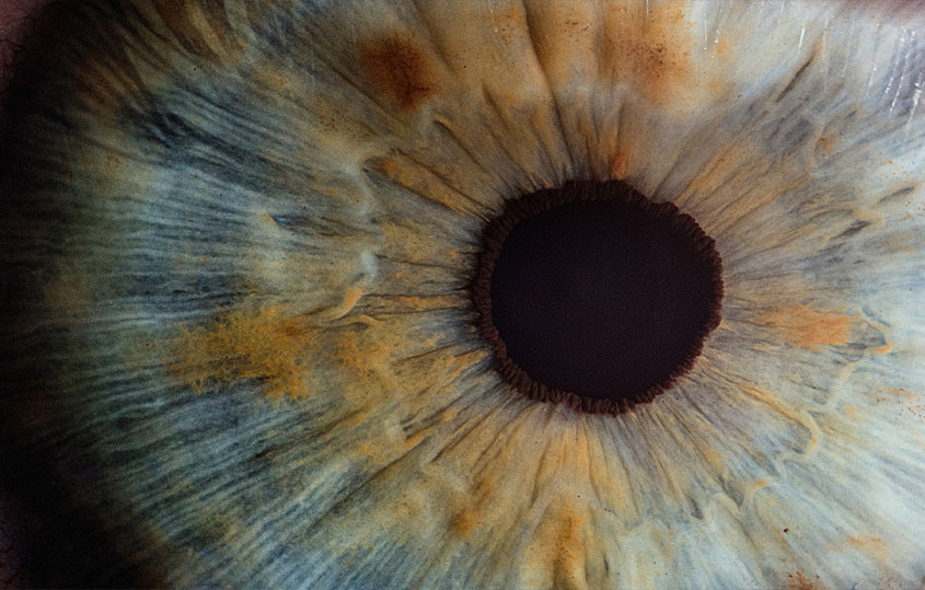 Ti interessa l’iridologia? 